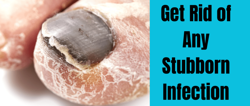 Get Rid of Any Stubborn Infection