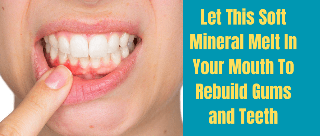 Let This Soft Mineral Melt In Your Mouth To Rebuild Gums and Teeth
